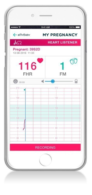 ND19_ML89304 Detektor tętna płodu sweetBeat